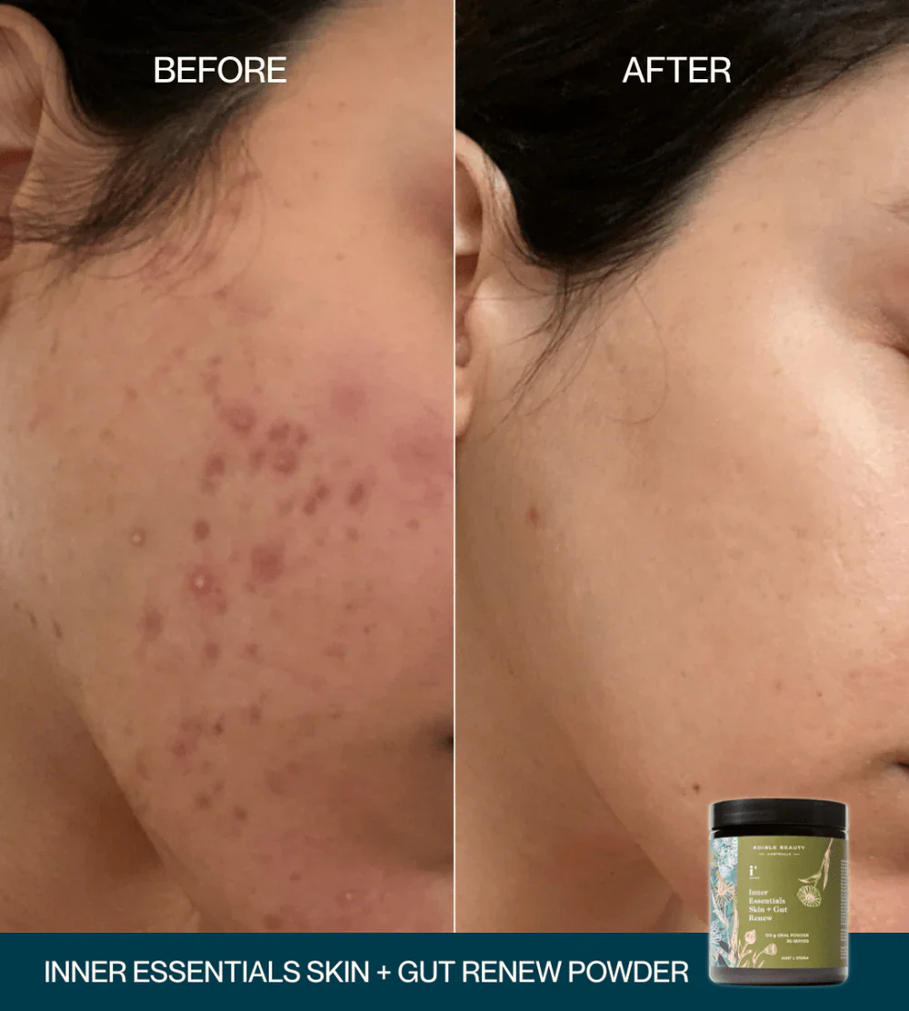 Edible Beauty Inner Essentials - Skin + Gut Renew Powder 120g - Image 4