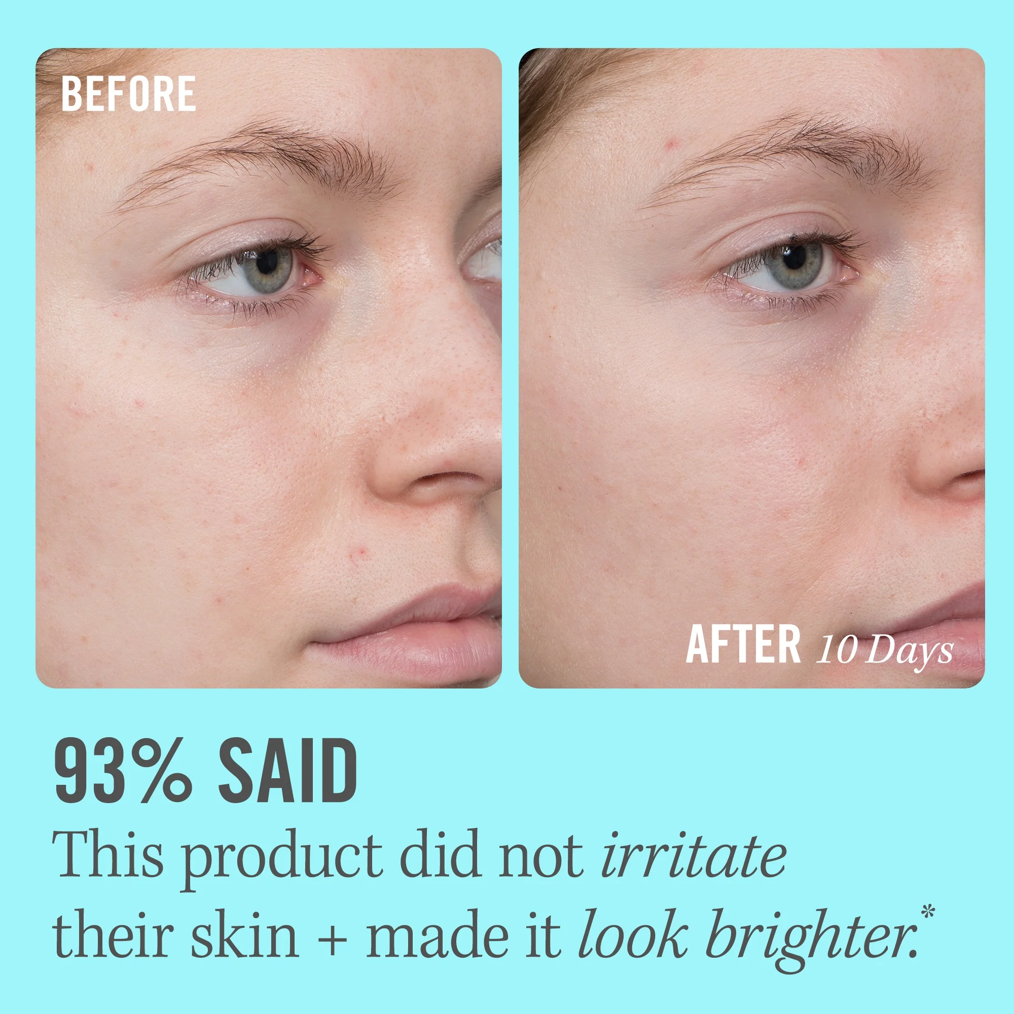 First Aid Beauty 10% Vitamin C Brightening Serum 1.7 oz - Image 3