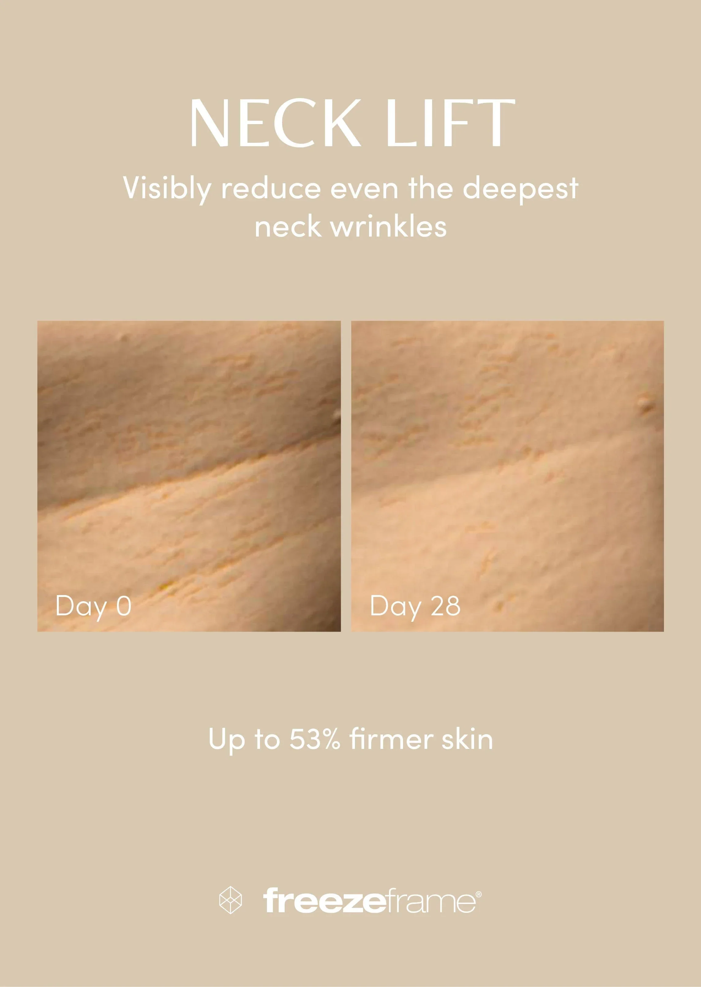 freezeframe Neck Lift 50ml - Image 5