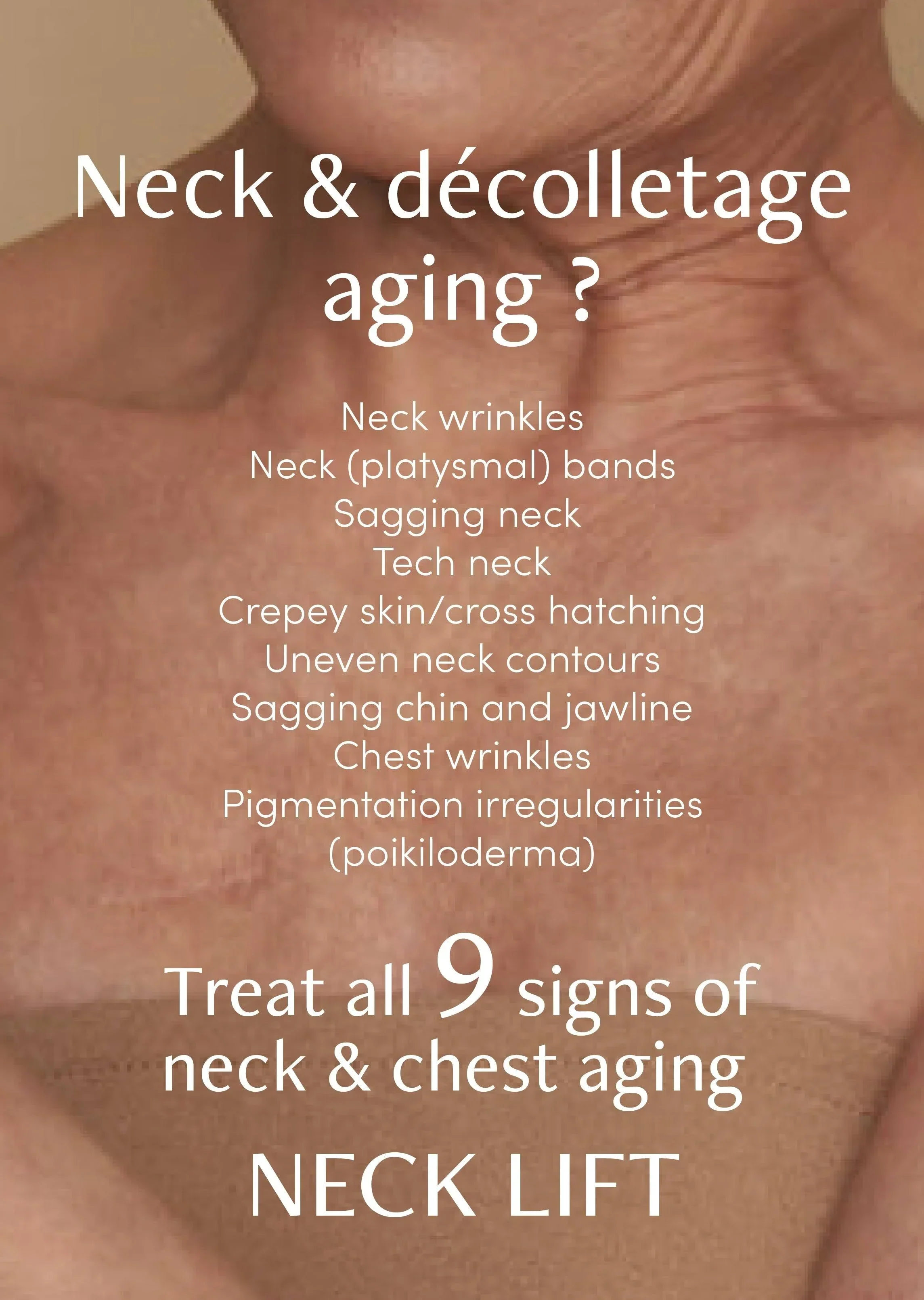 freezeframe Neck Lift 50ml - Image 6