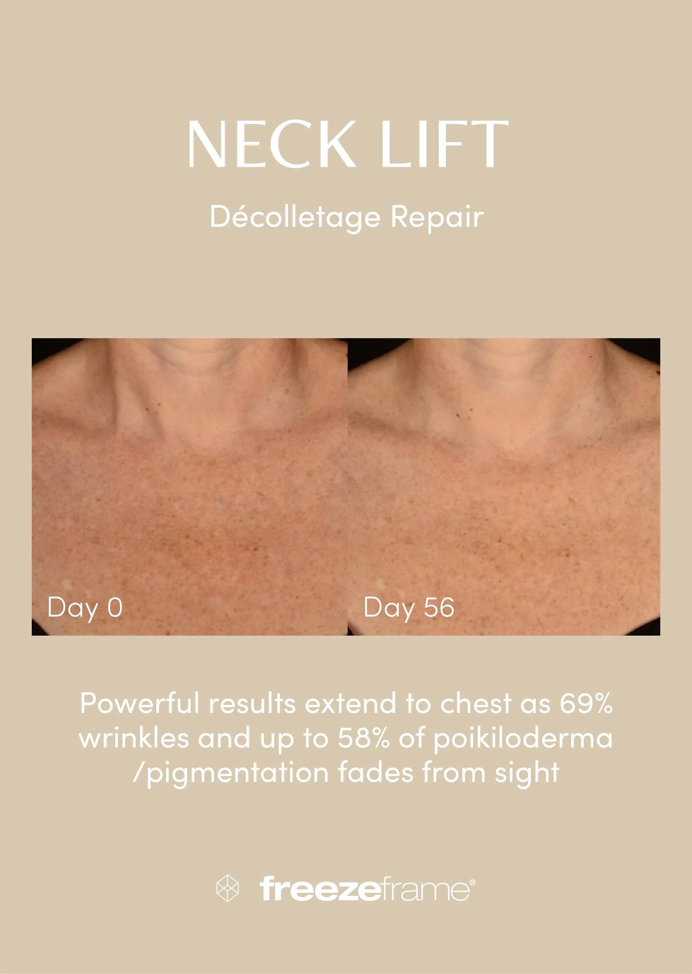 freezeframe Neck Lift 50ml - Image 8