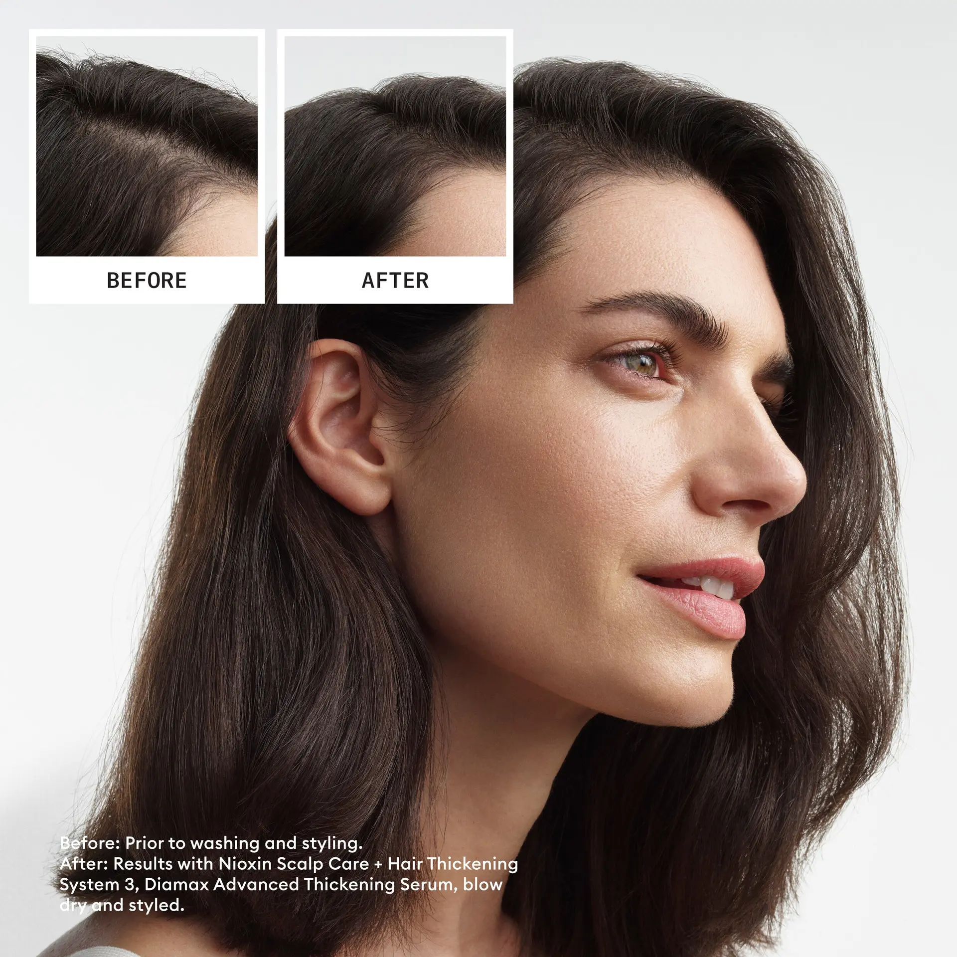 Nioxin Scalp + Hair Thickening System 3 Trial Kit - Image 5