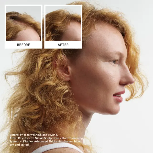 Nioxin Scalp + Hair Thickening System 4 Full Size Kit - Image 4