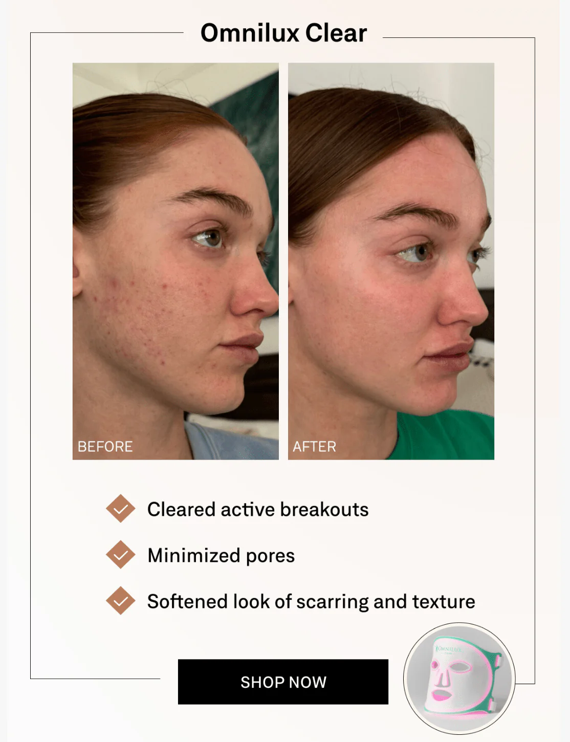 Omnilux Clear - Image 4
