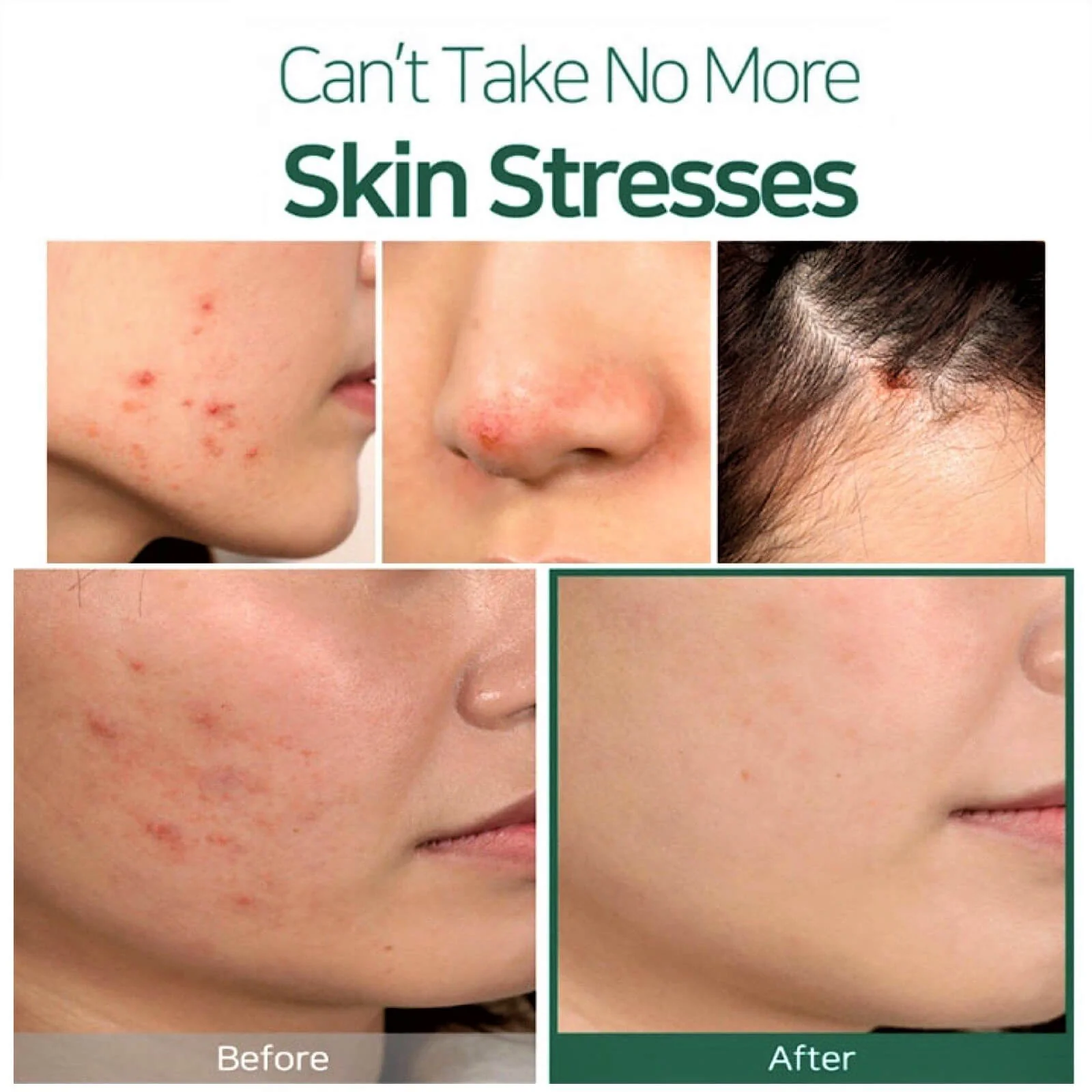SOME BY MI 30 Days Miracle Tea Tree Clear Spot Oil 10ml - Image 2