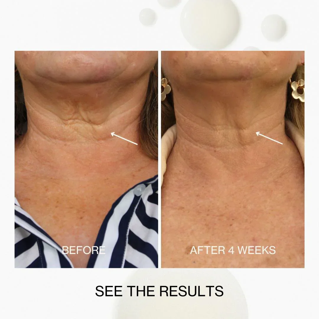 The Jojoba Company Neck & Decolletage Lifting Concentrate 50ml - Image 5
