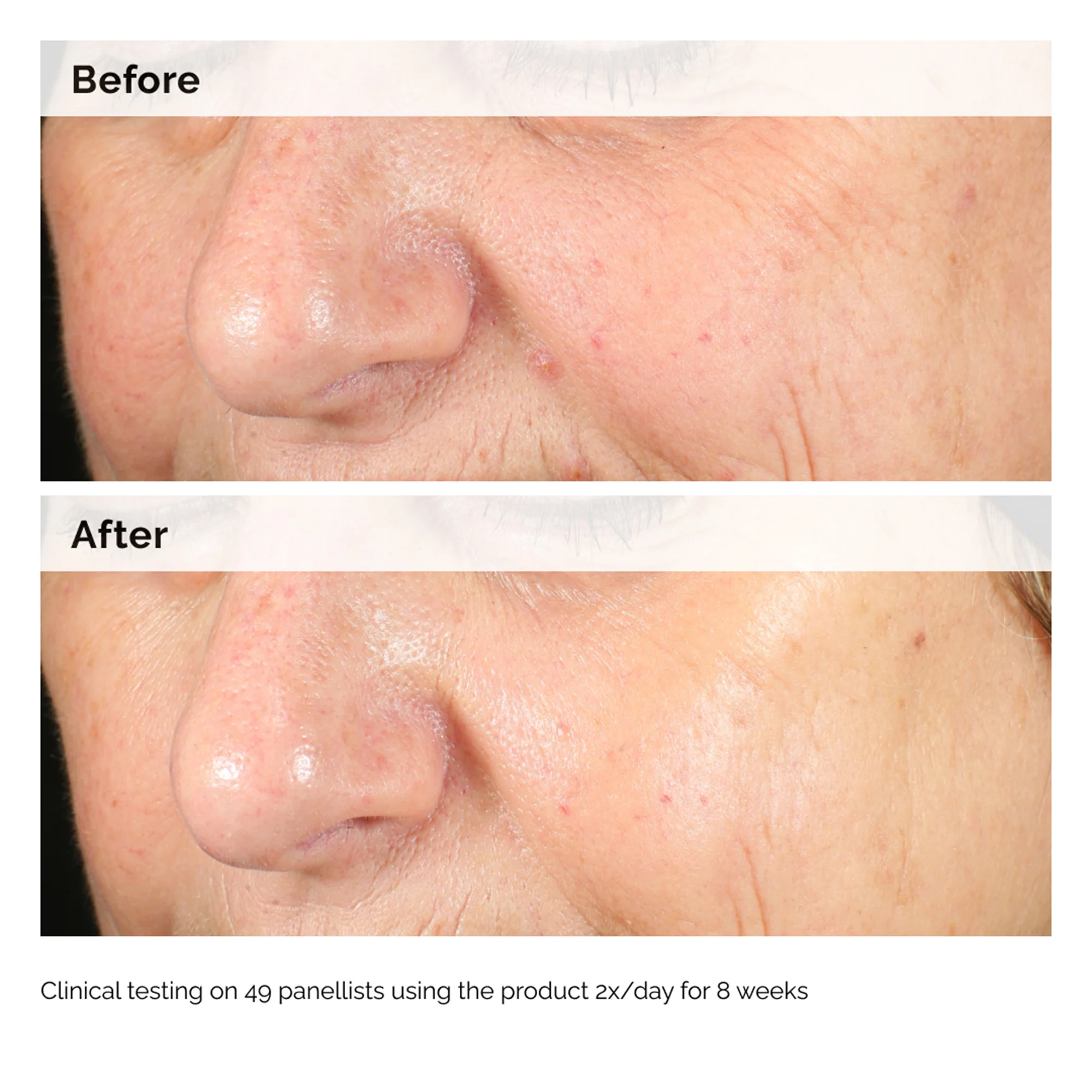 The Ordinary Alpha Arbutin 2% + HA 60ml - Image 11