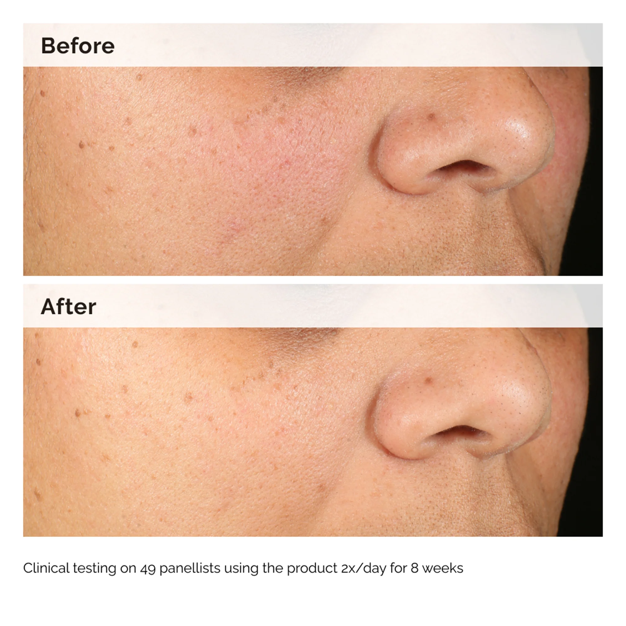 The Ordinary Alpha Arbutin 2% + HA 60ml - Image 8