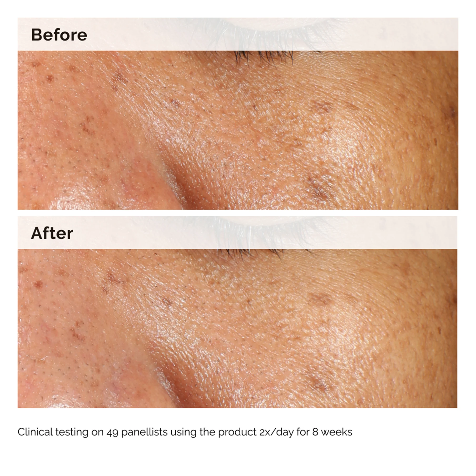 The Ordinary Alpha Arbutin 2% + HA 60ml - Image 9