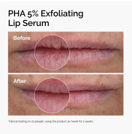The Ordinary PHA 5% Exfoliating Lip Serum 15ml - Image 2